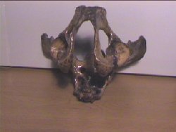 Pelvis 351