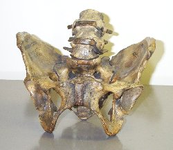 Pelvis 354
